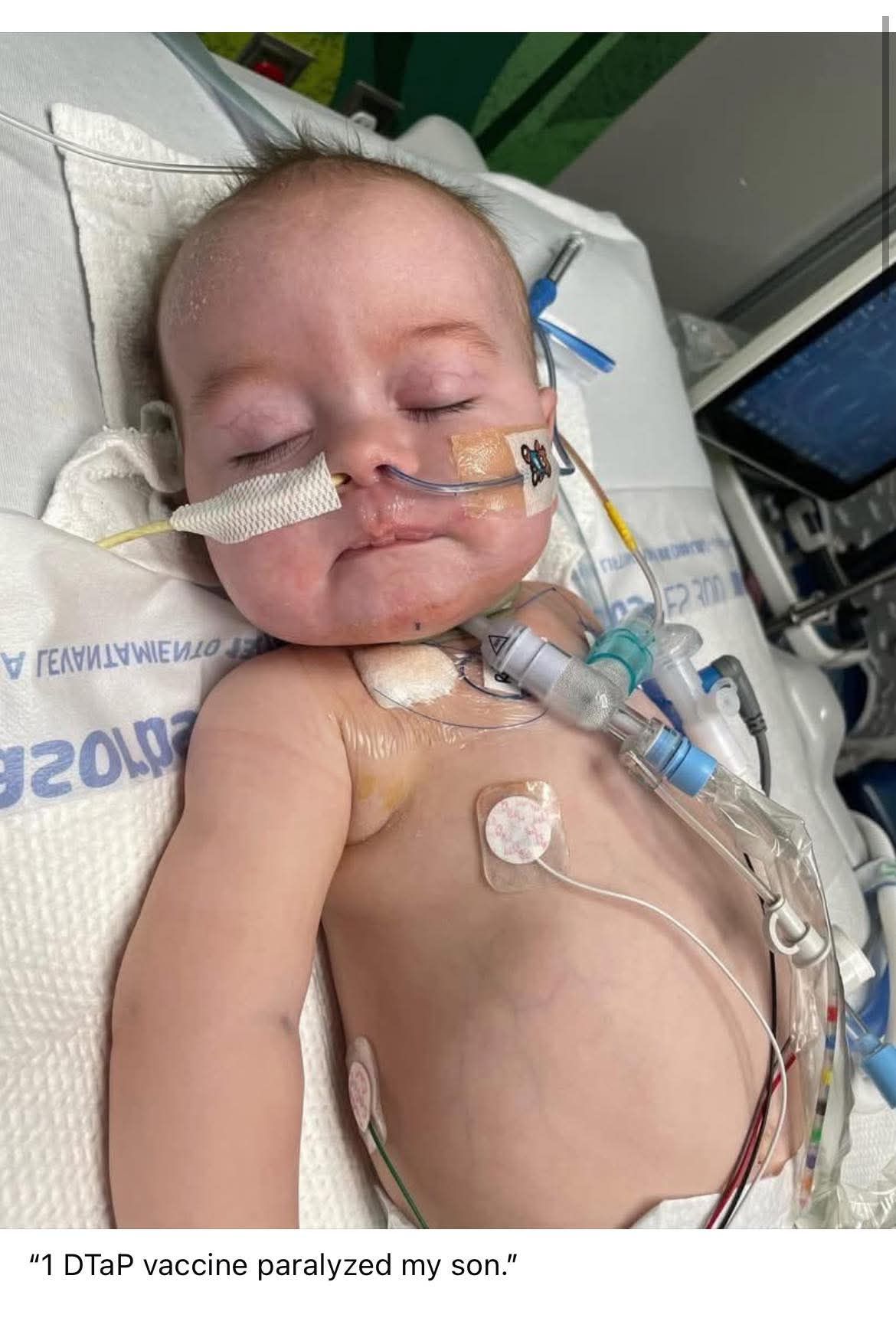 1 DTaP vaccine paralyzed my son